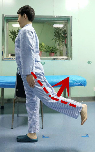 青年医师亲身示范!膝关节疼痛锻炼方法